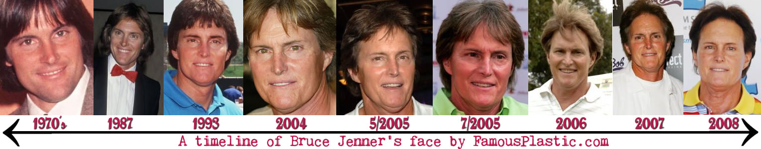 Bruce Jenner.